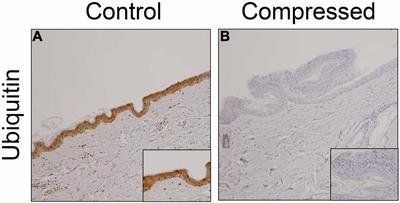 Forensic Application of Epidermal Ubiquitin Expression to Determination of Wound Vitality in Human Compressed Neck Skin